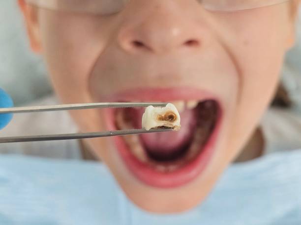 Best Cosmetic Emergency Dentistry in Union Hall, VA
